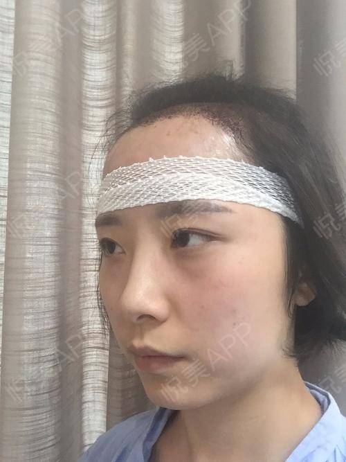 额头长白毛预示着什么吉凶？