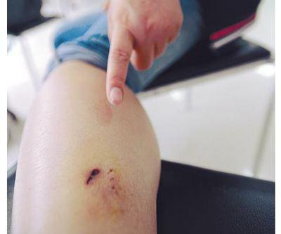 如何根据四柱八字里防动物咬伤的中医病名来调整预防措施？