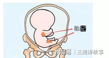 八字与胎记,胎记跟命运有关系吗