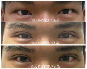 男人右眼皮跳是吉是凶？有什么预兆？