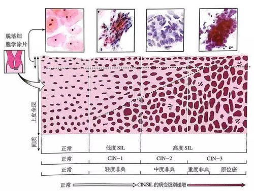 病变吉凶是否意味着癌症的预后好坏？