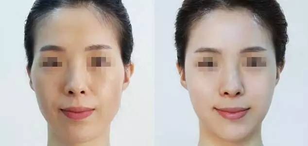 震惊！太阳穴塌陷竟暗示2026年大劫？女人必看的面相玄机