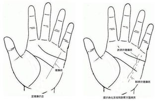 五、 掌心凹陷与太阳丘隆起——有钱却存不住的大坑洞模式⚠️⚠️⚠️