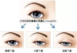 眼睛离眉毛的距离远好还是近好,眼睛离眉毛近风水