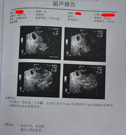 一、先来点儿“噪音”——随手写的碎碎念