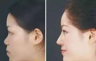 鼻子歪的人命运和性格是否都特别不幸怪异？