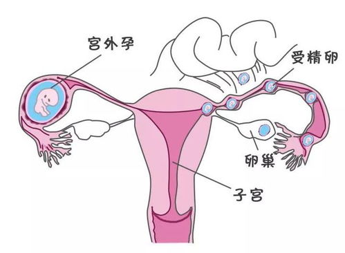 一、 先把“月经不来”的谜团拆开包装