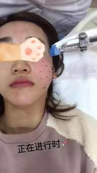 梦见别人脸上全是血，这究竟是什么预兆，吓醒了我？