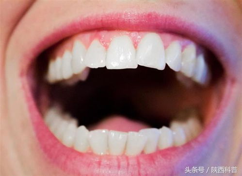 梦见牙齿大量脱落并吐出，这是怎么回事呢？