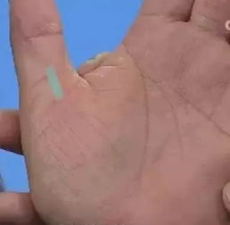 手相中哪些特征能准确反映健康状况？