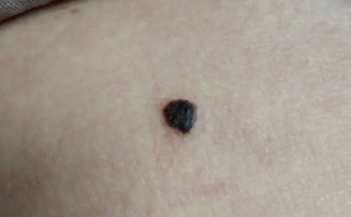 一、 常见病变与非典型特征