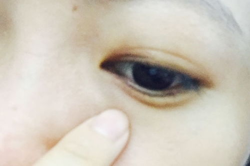 左眼眼角频繁跳动，这是否预示着什么吉凶？