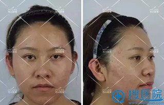 案例二：安徽一对较小情侣的悲剧