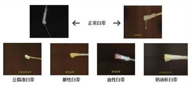 1. 迅速应急法：用当前这个神奇物品立刻去除异味