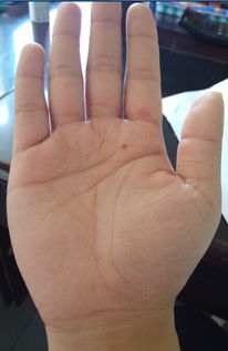 手掌纹hen多杂纹是什么原因,手掌纹hen多杂纹