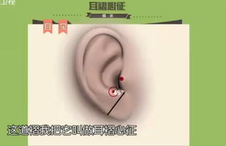耳朵发热预示吉凶，如何化解及具体实例分析？