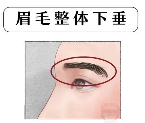 鼻子过较长