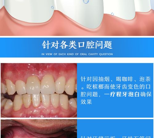 #4 清爽后的第一口气息