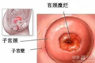 精子先生们：你们在泥潭里游泳呢！