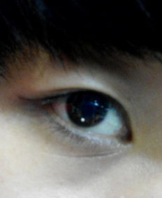 眼睛下方八字线纹是侧睡压出来的吗？