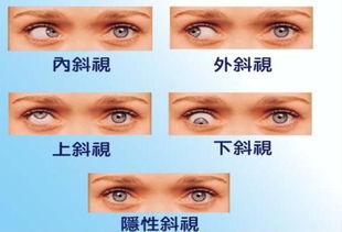 如何通过左眼眉跳准确判断吉凶？