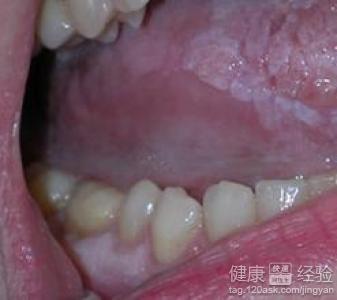 口腔风水代表那个方位,口腔疾病与风水