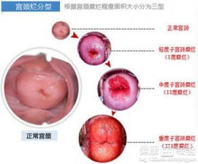 一、日常琐事：谁说生活不能像诗？