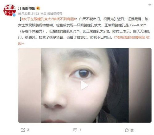 一、乱弹：左眼跳到底是啥玩意儿？