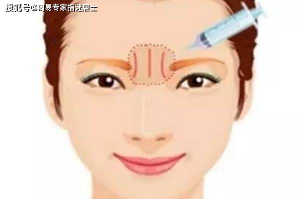 眉间八字纹女人命运如何改写，面相好坏预示着什么？