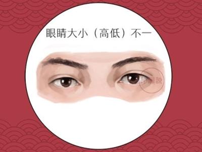 八字火太旺对眼睛健康有影响吗？适合从事哪些行业？