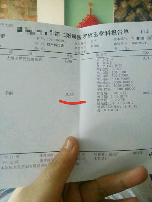 (噪音插段)