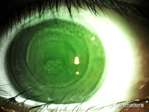 第二章：血瞳传说与生肖宿命