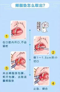 肉颤和脸颊发烫能准确预测吉凶吗？