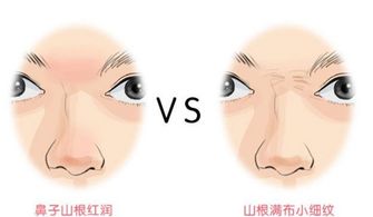 2.2 鼻尖形态