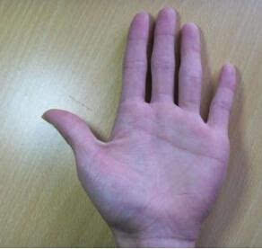 第四种：手掌大得能扇风但是不僵硬