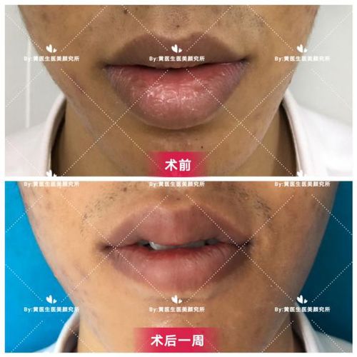 下嘴唇厚上嘴唇薄的男生面相有什么特点？