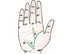 生命线分叉：手掌里的狗血剧情