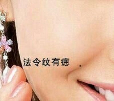 意外阻碍：鼻梁上的痣