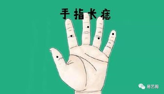 六、小指上的痣：子孙后代的祝福