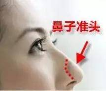 3.2 鼻息肉