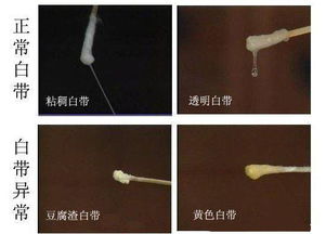 * 噪音插曲：随机脑洞时间段 *