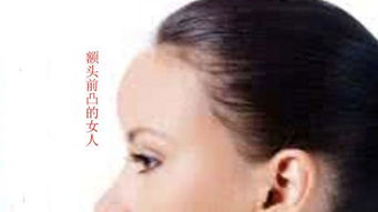 女人额头高广：嫩力太强反而难嫁