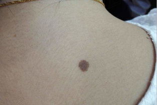 1、 额头的桃花痣：智慧与魅力的混搭套餐