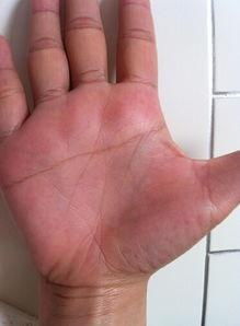 假断掌与真断掌有何命运差异？