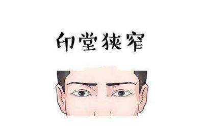 社交圈子窄得可怕