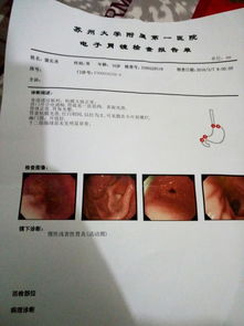 二、 症状清单（别较小看这一些“较小毛病”）