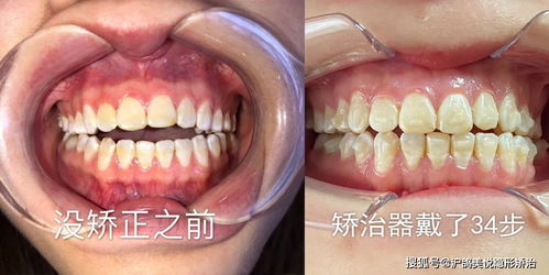 敲木鱼模拟器：一窥禅意与科学研究技术手段的融合