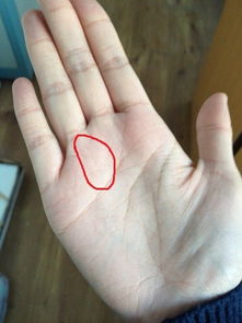 不同位置的太阳线的具体含义