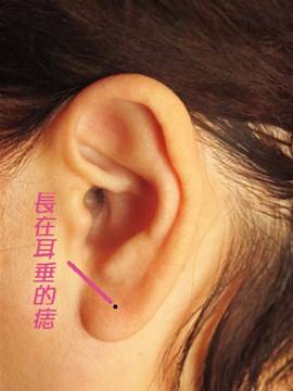 耳垂上的吉痣：纯良之心的福报