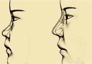 塌鼻子的女生真的命苦吗？看完这篇你就懂了